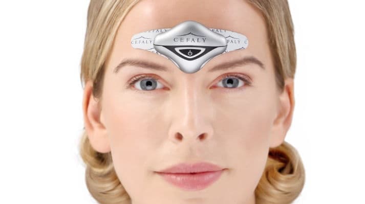 Supraorbital Transkutanöz Stimülasyon - Cefaly